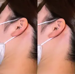 うなじWax脱毛🍯✨