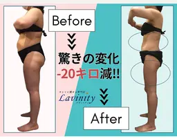 体重以上に見た目が変わる★ダイエットプログラム+セル脂肪痩身フル体験115分