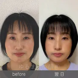 エステの枠を超えた変化♡優しいタッチの小顔矯正【頭蓋骨調整＋タルミ解消フェイシャル＋頭蓋骨ケア】65分 半額の6500円