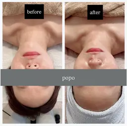 【小顔リフト】オールハンドリフトアップ＋デコルテマッサージ付　60分