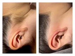 うなじを綺麗に整えたい！そんな方へ！