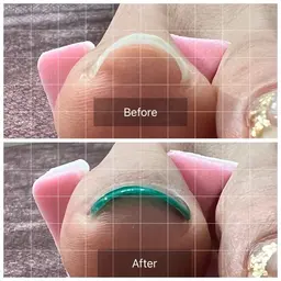 巻き爪UPジェル　オフなし