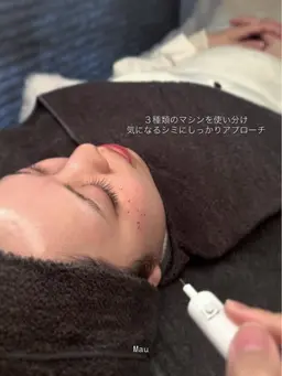 【シミケア】-低周波シミケアで肌負担なくシミにアプローチ！戻りジミのリスクなし✨シミケア20分までし放題