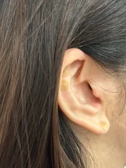 耳つぼ整体(ジュエリー無し)