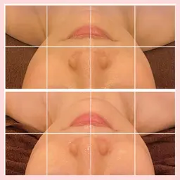 【コルギ&ハイパーナイフEX】小顔✕小顔🩷より小顔をキープできる‼️小顔コルギ矯正スペシャル✨