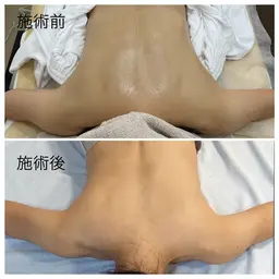 全身マッサージ60分、手から電気を流す施術のため、ペースメーカーやてんかんの方は申し訳ございませんが禁忌となります。