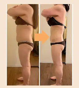 ブライダル痩身★ドレスが映える背中・二の腕に!60分集中メニュー