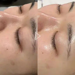 【ご新規様限定】【2回で5,500円】肌質改善フェイシャルエステ