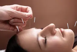 【口コミ必須】クイック美容鍼30分【平日限定特別コース】