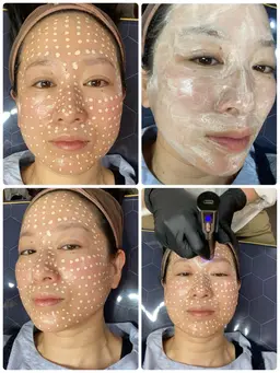 【メソスキンカラー】体験 毛穴洗浄+角質ケア16500円 ※空き枠ない場合メッセージ下さい