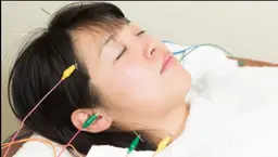 【スタンダート】ぷるぷる美容鍼