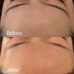 フェイスシェービング(お顔剃り)