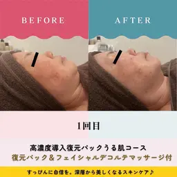 【毛穴・たるみ・美白・むくみ・シミ・シワに最適👍)真夏の日差し負けないお肌に🌟磁気復元パックケア
