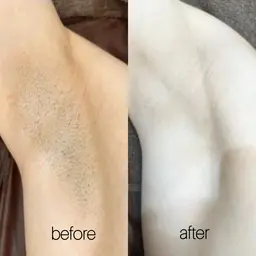 【女性限定】Ｓパーツ1箇所¥500🎀何箇所でも可能！