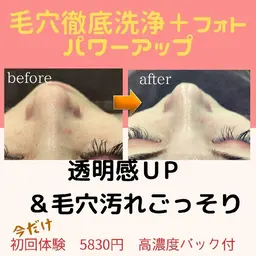 毛穴徹底洗浄+美肌光ケア❤️ハリ弾力潤いUPの美白肌へ✨通常13750円→8800円