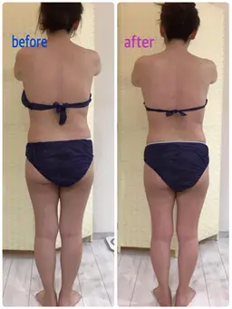 ハイパーナイフ&ハイパーシェイプ&リンパ滝汗岩盤マットつき120分