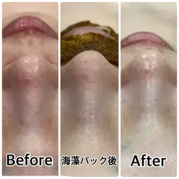 【本日来店限定◆全顔3D毛穴洗浄】今から対策!寒い時期も輝く透明肌¥3980