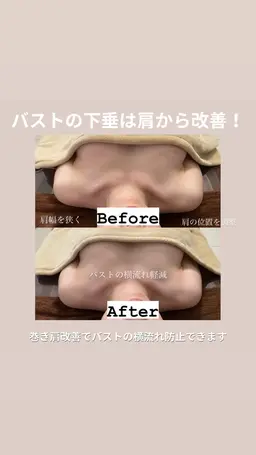 人気NO.2⭐️下垂・ハリ・巻き肩・猫背にお悩みの方⭐️効果実感度99%！全てのバスト悩み改善◎