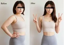 【痩身】オンダボディ：脂肪除去＆セルライト＆引き締めの3大効果！ONDAの価格革命 ※3箇所