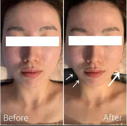 【頭脳美クレンズ小顔調整】脳脊髄液に着目した小顔調整