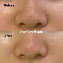 フェイシャルwax(眉込み) ¥8,000→6800