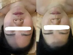 【疲れを取りたい方向け】ヘッド•デコルテマッサージ