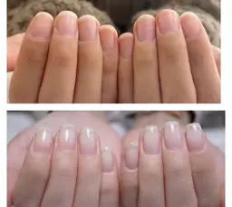 自爪育成ネイルケア+自爪育成クリアジェル