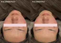 LDM水玉リフティング