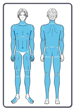 全身脱毛(顔、VIO以外)