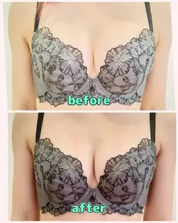 マシュマロバストマッサージ+うる艶アップ光照射