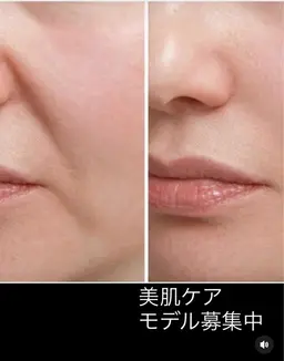 フェイスエステ