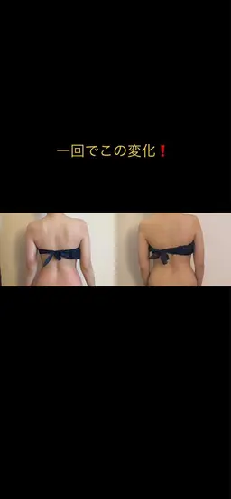 くびれ痩身エステ【キャビテーション】【ラジオ波】【吸引】【ハンドトリートメント】お腹＆背中　60分