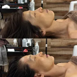 【小顔ヘッドスパ】頭蓋骨の歪み改善＋間延びした顔やエラ張りさん、目の開きを改善させ魅力的な表情に