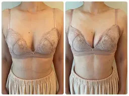 お試しバストアップ(デコルテのみ)