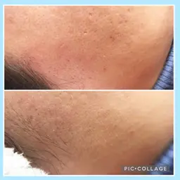 🥝フェイシャルワックス