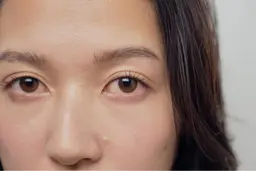 🧊【毛穴洗浄、肌質改善set✨】ハイドロスプラッシュ＋カーボキシー