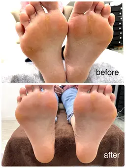 フットバス付！足の角質ケア！