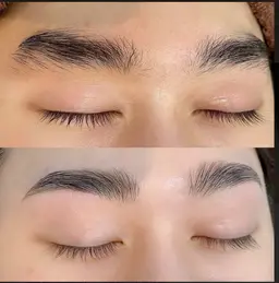 ハリウッドブロウリフト(男性)