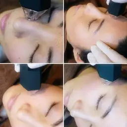 サイエンス美容プログラム✨14日間✨プラズマニードル