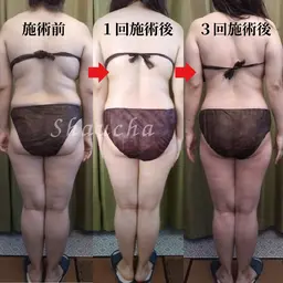 人気No1【オールハンド技術⭐全身痩せコース】【期間限定モニター価格】150分\29000円➡️\19800!!