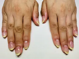 フレンチ 逆フレンチ フラット、ナナメフレンチ、当店ソフトオフ込み(補足説明もご覧ください)