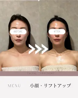 モニター募集🔴小顔になりたい方、ぜひ協力をお願いします