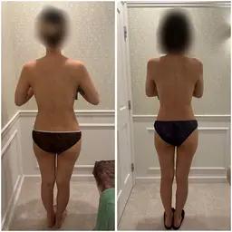 🉐エステ×整体×ツボ経絡の技✨️骨格矯正オイルトリートメント60分☘【全身むくみ撃退】【O脚、巻き肩、反り腰改善】