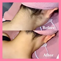 人気１位🥇【うなじ脱毛】形決めシェービング付き✨特別価格✨『美人は後ろ姿も綺麗』次回予約で2回目も1500円❣