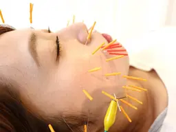 【初回】スタンダード美容鍼（カウンセリング込）