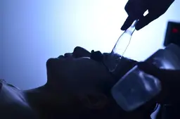 肌質改善：光フェイシャル1回