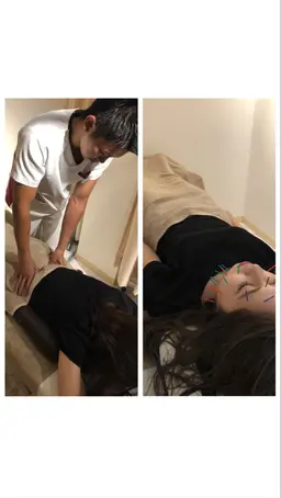 人気メニュー美容鍼+美容整体セット顔だけではなく一緒に身体のメンテナンスを行う事でフェイスラインもスッキリします。