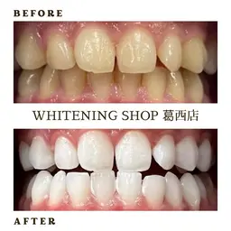 《ミニモ学割》U24割💎美白ホワイトニング 20分✕10回照射¥ 26,400→¥19,800