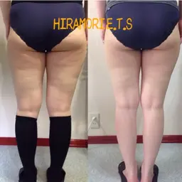 ボディー部分集中引き締めケア