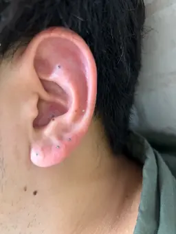 耳つぼジュエリーなし 両耳で12粒